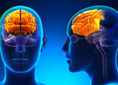 🧠 Atrofia no Córtex Pré‑Frontal em Pessoas com Esquizofrenia com Idade por Volta dos 50 Anos